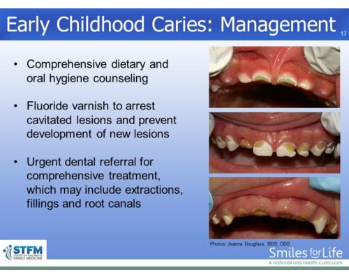 Module 6 Slide 17