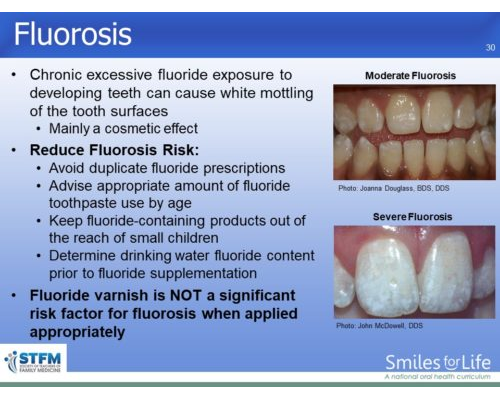 Module 6 Slide 30