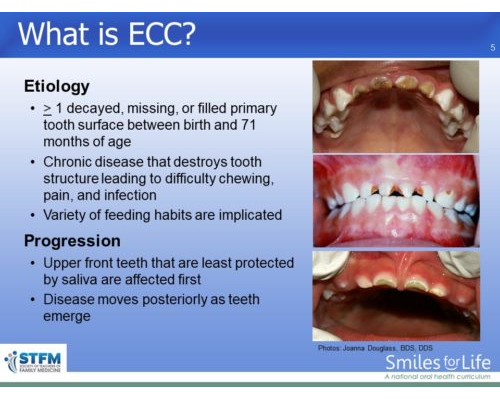 Module 6 Slide 5