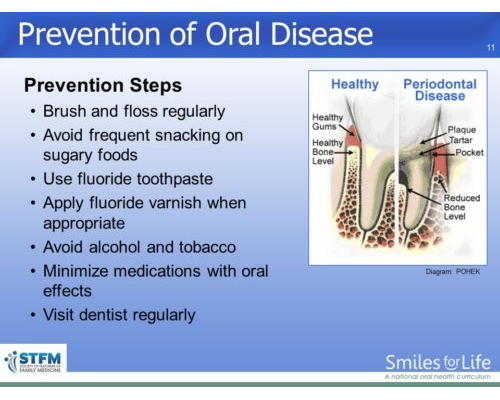 Module 3 Slide 11