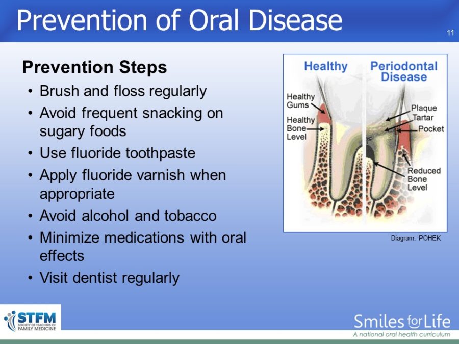 Module 3 Slide 11