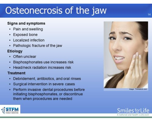 Module 3 Slide 14