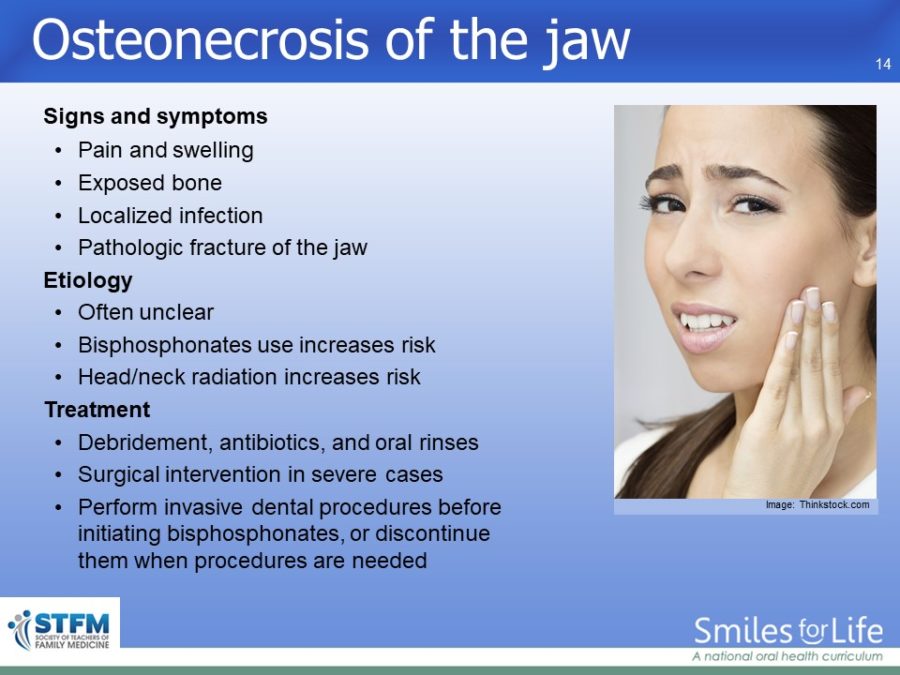 Module 3 Slide 14