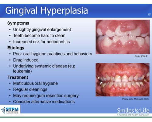 Module 3 Slide 15