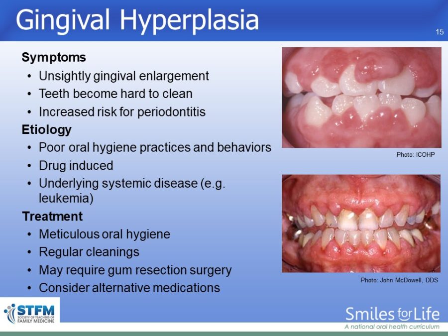 Module 3 Slide 15