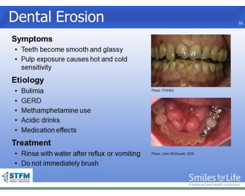 Module 3 Slide 16