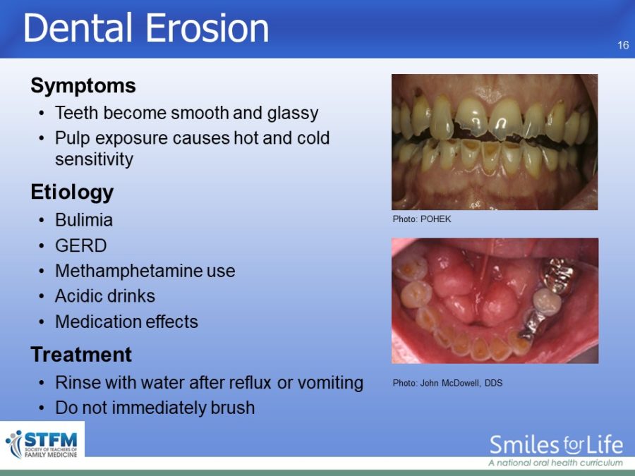 Module 3 Slide 16