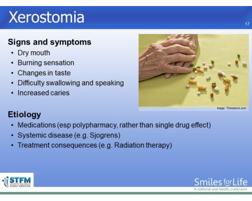 Module 3 Slide 17