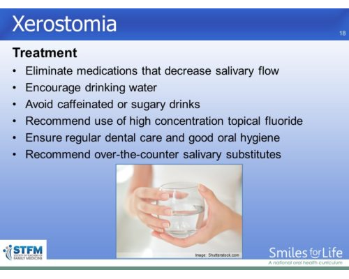 Module 3 Slide 18