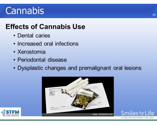 Module 3 Slide 20