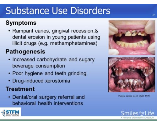 Module 3 Slide 21