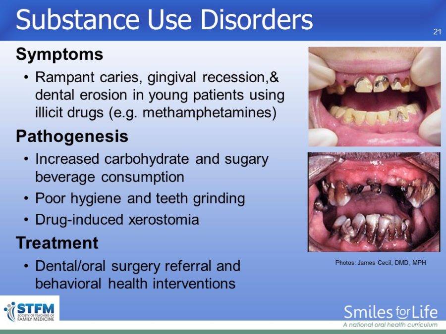 Module 3 Slide 21