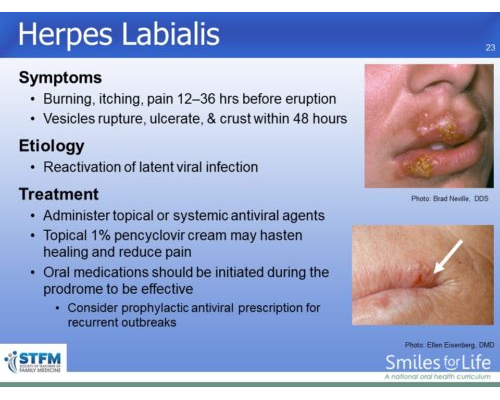 Module 3 Slide 23