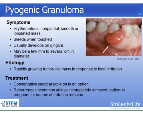 Module 3 Slide 24