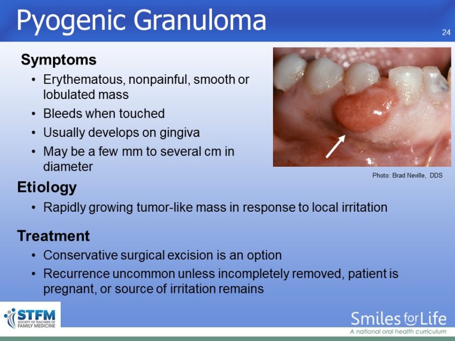 Module 3 Slide 24