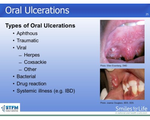 Module 3 Slide 25