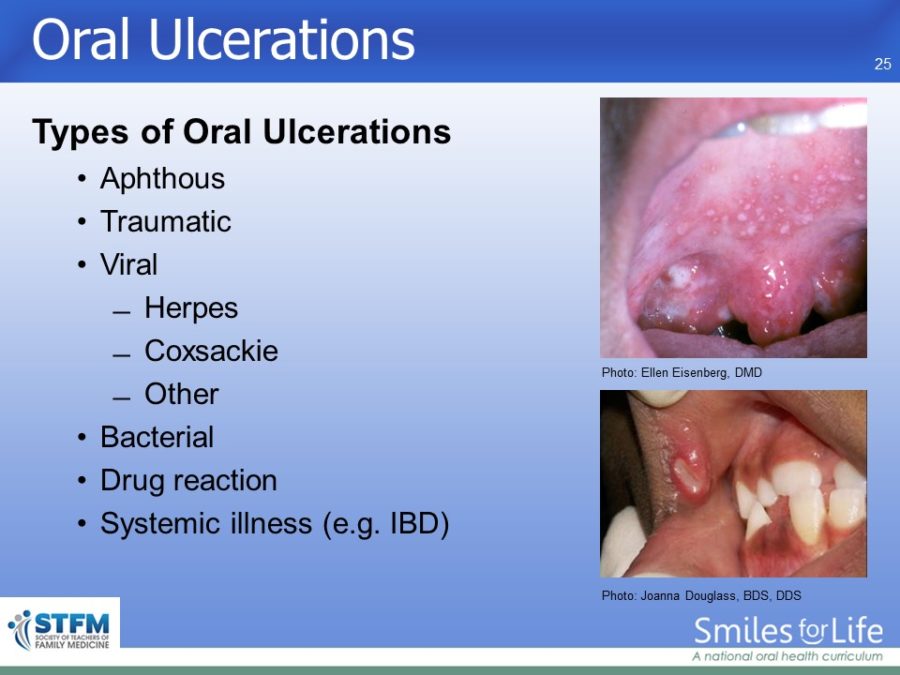 Module 3 Slide 25