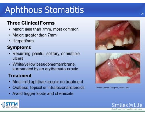 Module 3 Slide 26