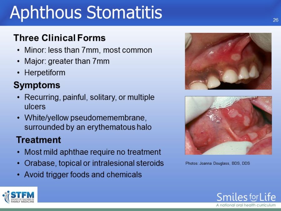 Module 3 Slide 26