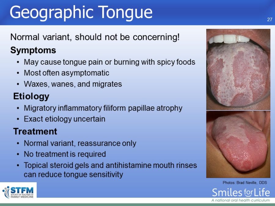 Module 3 Slide 27