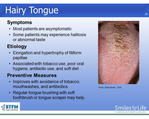 Module 3 Slide 28