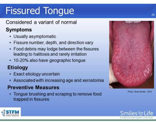 Module 3 Slide 29