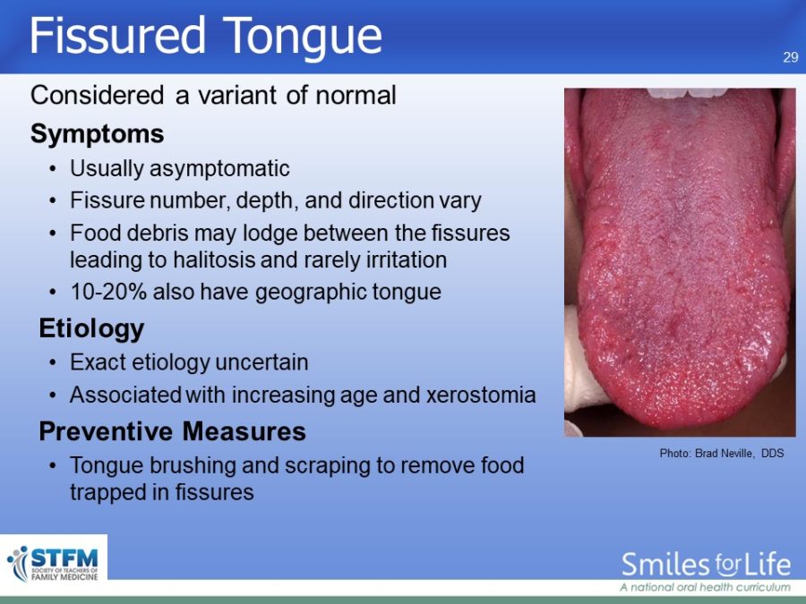 Module 3 Slide 29