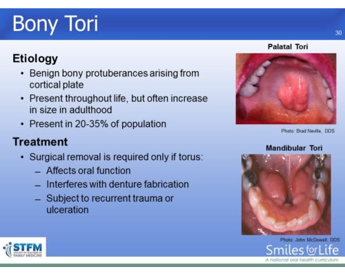 Module 3 Slide 30