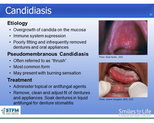 Module 3 Slide 31