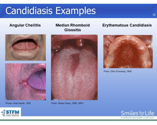 Module 3 Slide 32