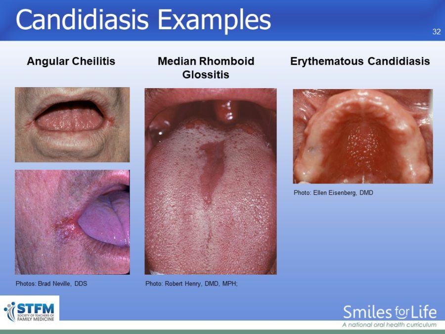 Module 3 Slide 32