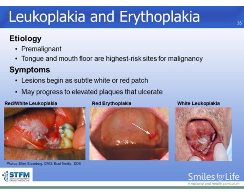 Module 3 Slide 35