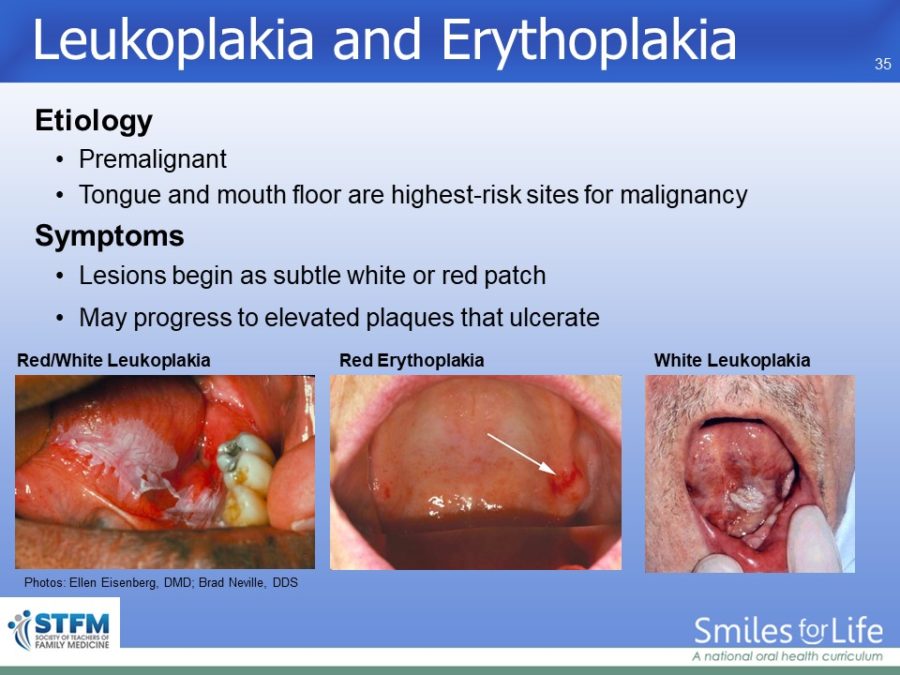 Module 3 Slide 35