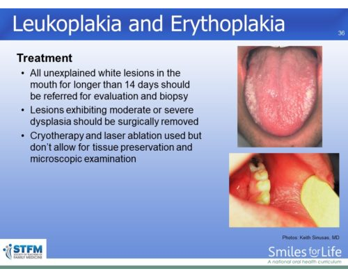 Module 3 Slide 36