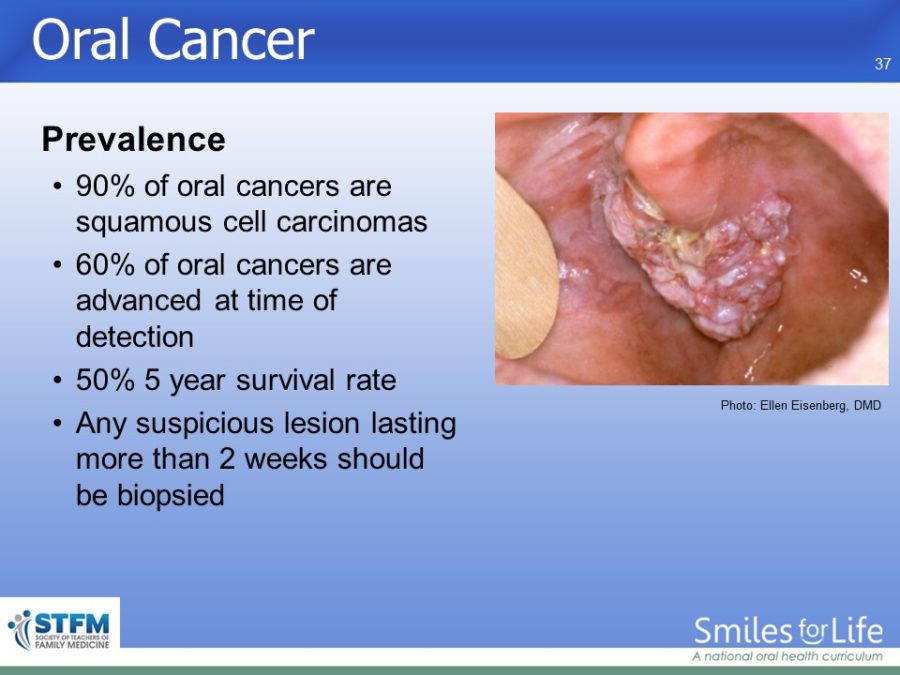 Module 3 Slide 37