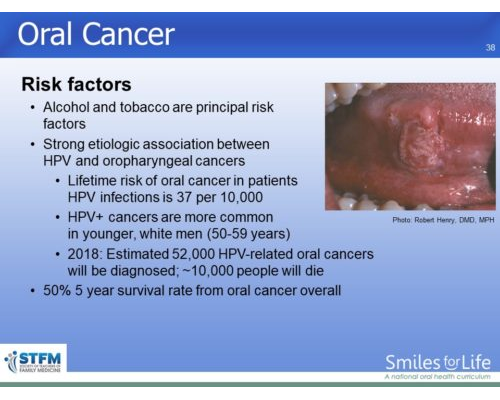 Module 3 Slide 33