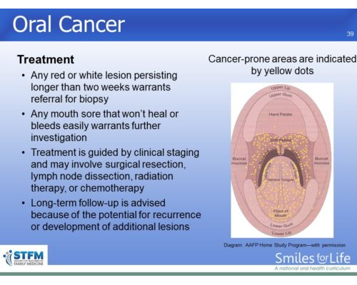 Module 3 Slide 34