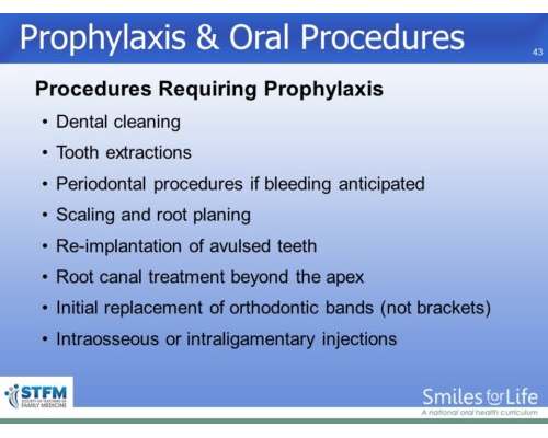 Module 3 Slide 43