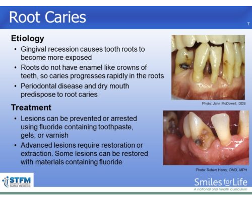 Module 3 Slide 7