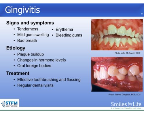 Module 3 Slide 8