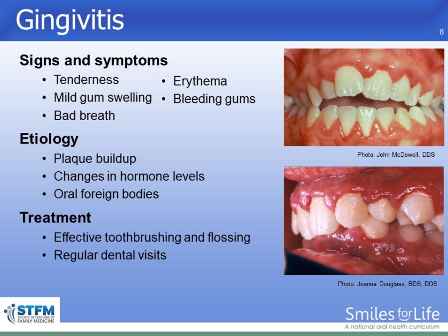 Module 3 Slide 8