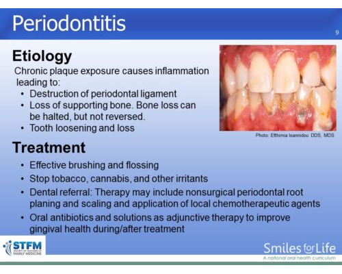 Module 3 Slide 9