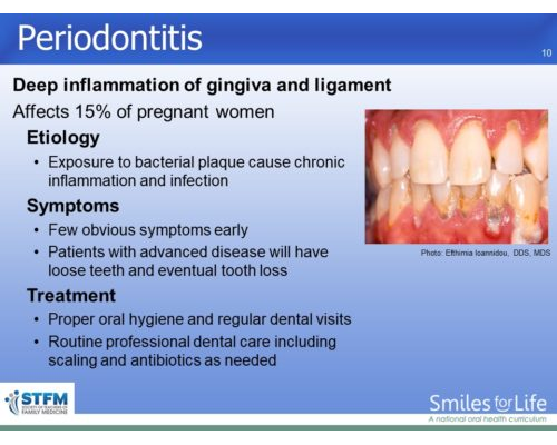 Module 5 Slide 10