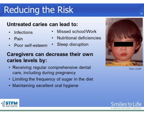 Module 5 Slide 14