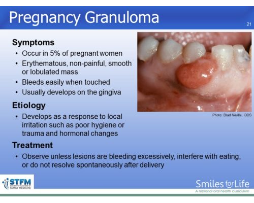 Module 5 Slide 21