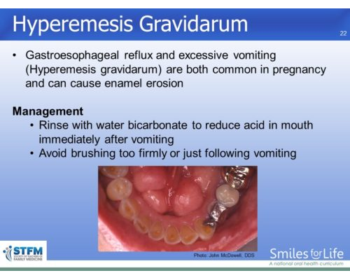 Module 5 Slide 22