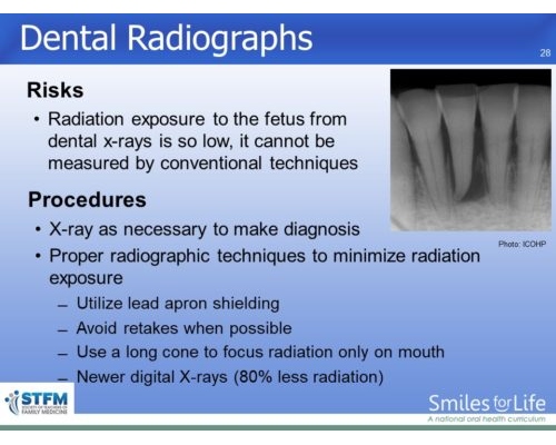 Module 5 Slide 28