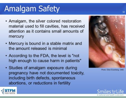 Module 5 Slide 32