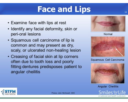 Module 8 Slide 14