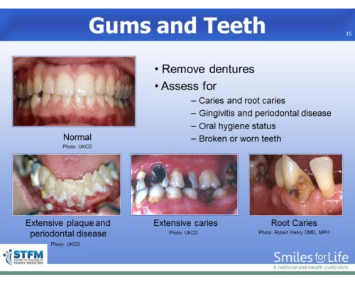 Module 8 Slide 15